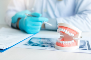 Dental model sitting on a dentist’s desk with an X-ray